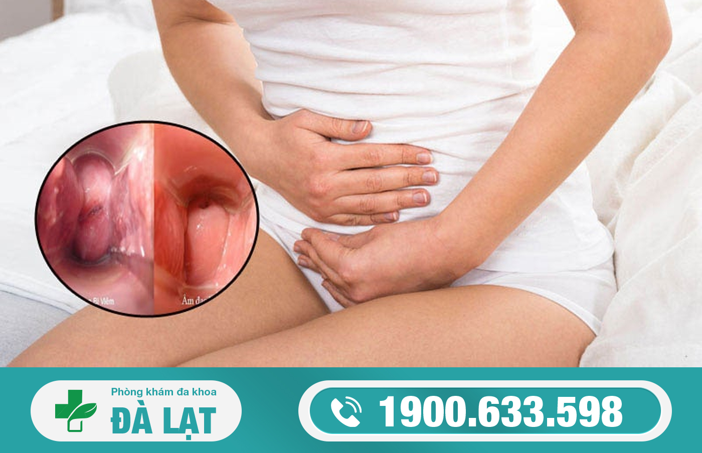 XÉT NGHIỆM GIANG MAI Ở ĐÂU UY TÍN?